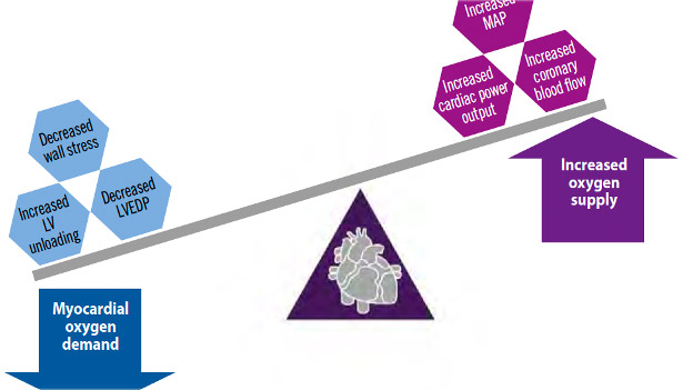Expert Review : pLVAD and complex high-risk PCI