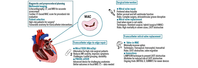 Expert Review: Mitral annular calcification